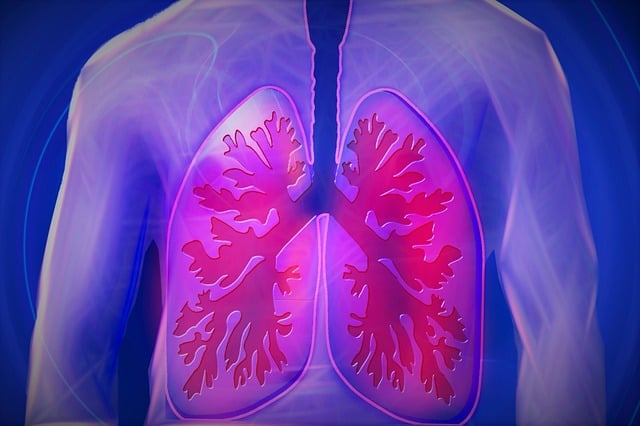 pulmão com tuberculose